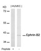 Western blot analysis of lysed extracts from HUVEC cells using Ephrin-B2 (Ab-316) .