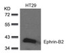 Western blot analysis of lysed extracts from HT29 cells using Ephrin-B2 (Ab-330) .