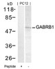 Western blot analysis of lysed extracts from PC12 cells using GABRB1 (Ab-434) .