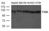 Western blot analysis of extract from HepG2, 293, C6, HUVEC and HT29 cells using FAK (Ab-397) .