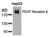 Western blot analysis of lysed extracts from HepG2 cells using PDGF Receptor &#946; (Ab-751) .