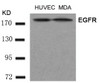 Western blot analysis of lysed extracts from HUVEC and MDA cells using EGFR (Ab-1197) .