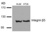 Western blot analysis of lysed extracts from HL60 and HT29 cells using Integrin &#946;3 (Ab-785) .