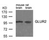 Western blot analysis of lysed extracts from mouse brain and rat brain tissue using Glutamate receptor 2 (Precursor) (Ab-880) .