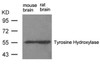 Western blot analysis of extract from rat brain and mouse brain using Tyrosine Hydroxylase (Ab-31) .