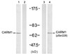 Western blot analysis of lysed extracts from A431 cells untreated or treated with EGF (200 ng/mL, 5 min) , using CARM1 (Ab-228) antibody (Line 1 and 2) and CARM1 (Phospho-Ser228) antibody (Line 3 and 4) .