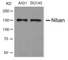 Western blot analysis of lysed extracts from A431 and DU145 cells using Niban Antibody.