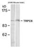 Western blot analysis of lysed extracts from A549 and mouse brain tissue using TRPC6 Antibody.