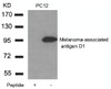 Western blot analysis of lysed extracts from PC12 cells using Melanoma-associated antigen D1 Antibody.