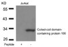 Western blot analysis of lysed extracts from Jurkat cells using Coiled-coil domain-containing protein 106 Antibody.