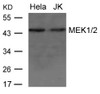 Western blot analysis of extract from HeLa and JK cells using MEK1/2 Antibody #21428