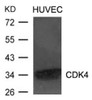 Western blot analysis of lysed extracts from HUVEC cells using CDK4 Antibody.