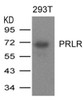 Western blot analysis of lysed extracts from 293T cells expressing human PRLR protein using PRLR Antibody.