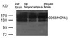 Western blot analysis of extract from rat brain, rat hippocampus and mouse brain using CD56 (NCAM) .
