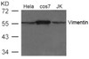 Western blot analysis of extract from HeLa, cos7 and JK cells using Vimentin Antibody.