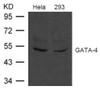Western blot analysis of extract from HeLa and 293 cells using GATA-4 Antibody.