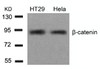 Western blot analysis of lysed extracts from HT29 and HeLa cells using &#946;-Catenin (Ab-654) .