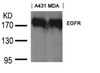Western blot analysis of lysed extracts from A431 and MDA cells using EGFR (Ab-1197) goat polyclonal Antibody.