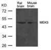Western blot analysis of extract from rat brain and mouse brain tissue using MEK5 Antibody.