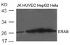 Western blot analysis of extract from JK, HUVEC, HepG2 and HeLa cells using ERAB Antibody.