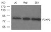 Western blot analysis of extract from JK, Raji and 293 cells using FOXP2 Antibody.