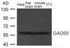 Western blot analysis of extract from Rat brain, Mouse brain tissue and HeLa, 3T3 cells using GAD65 (GAD2) ) .