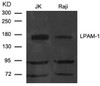 Western blot analysis of extract from JK and Raji cells using LPAM-1 (Integrin & CD49d) .