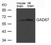 Western blot analysis of extract from Rat brain and Mouse brain Tissue using GAD67 (GAD1) .