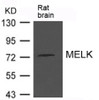 Western blot analysis of extract from Rat brain tissue using MELK Antibody.