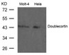 Western blot analysis of extract from Molt-4 and HeLa cells using Doublecortin Antibody.