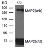 Western blot analysis of extract from Rat brain and Mouse brain Tissue using MAP2 Antibody.