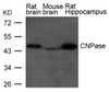 Western blot analysis of extract from Rat brain, Mouse brain and Rat hippocampus Tissue using CNPase Antibody.
