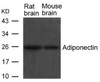 Western blot analysis of lysed extracts from Rat and Mouse brain tissue using Adiponectin Antibody.