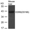 Western blot analysis of lysed extracts from Mouse liver tissue using CCR5 (CD195) .
