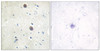 Immunohistochemical analysis of paraffin-embedded human brain tissue using Amyloid beta A4 (phospho-Thr743/668) antibody (left) or the same antibody preincubated with blocking peptide (right) .