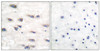 Immunohistochemical analysis of paraffin-embedded human brain tissue, using Trk A (phospho-Tyr791) antibody (left) or the same antibody preincubated with blocking peptide (right) .