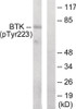 Western blot analysis of extracts from Hela cells treated with serum using BTK (phospho-Tyr223) Antibody. The lane on the right is treated with the antigen-specific peptide.