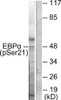 Western blot analysis of extracts from HepG2 cells treated with EGF using C/EBP-alpha (phospho-Ser21) Antibody. The lane on the right is treated with the antigen-specific peptide.