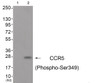 Western blot analysis of extracts from A549 cells (Lane 2) , using CCR5 (Phospho-Ser349) Antibody. The lane on the left is treated with antigen-specific peptide.