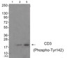 Western blot analysis of extracts from JK cells (Lane 2) and K562 cells (Lane 3) , using CD3 ζ (Phospho-Tyr142) Antibody. The lane on the left is treated with antigen-specific peptide.
