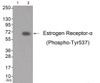 Western blot analysis of extracts from K562 cells (Lane 2) , using Estrogen Receptor-alpha (Phospho-Tyr537) Antibody. The lane on the left is treated with antigen-specific peptide.