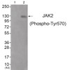 Western blot analysis of extracts from JK cells (Lane 2) , using JAK2 (Phospho-Tyr570) Antibody. The lane on the left is treated with antigen-specific peptide.
