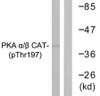 Western blot analysis of extracts from mouse brain cells using PKA alpha/beta CAT (Phospho-Thr197) Antibody. The lane on the right is treated with the antigen-specific peptide.