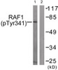 Western blot analysis of extracts from Jurkat cells treated with Paclitaxel using Raf1 (Phospho-Tyr341) Antibody. The lane on the right is treated with the antigen-specific peptide.