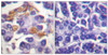 Immunohistochemical analysis of paraffin-embedded human pancreas tissue using Raf1 (Phospho-Tyr341) antibody (left) or the same antibody preincubated with blocking peptide (right) .