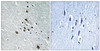 Immunohistochemical analysis of paraffin-embedded human brain tissue using SF1 (Phospho-Ser82) antibody (left) or the same antibody preincubated with blocking peptide (right) .