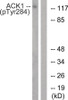 Western blot analysis of extracts from HepG2 cells treated with EGF using ACK1 (Phospho-Tyr284) Antibody. The lane on the right is treated with the antigen-specific peptide.