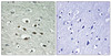 Immunohistochemical analysis of paraffin-embedded human brain tissue using Chk1 (Phospho-Ser296) antibody (left) or the same antibody preincubated with blocking peptide (right) .