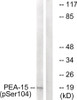 Western blot analysis of extracts from COS cells treated with TNF using PEA-15 (Phospho-Ser104) Antibody. The lane on the right is treated with the antigen-specific peptide.