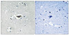 Immunohistochemical analysis of paraffin-embedded human brain tissue using Ras-GRF1 (Phospho-Ser916) antibody (left) or the same antibody preincubated with blocking peptide (right) .